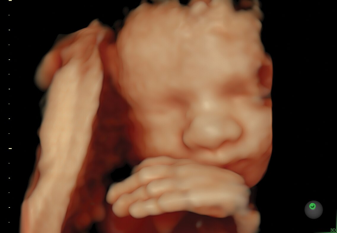 29 week fetal face and hand rendered with HDlive™