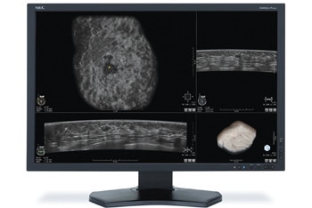 Invenia ABUS Workstation