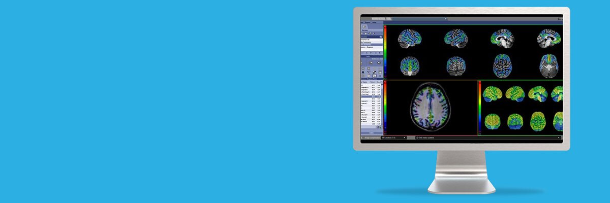 spotlight-cortexid