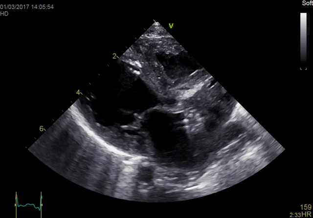 Neonatal Heart Imaging