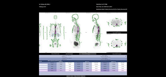 NM/CT 870 DR | GE Healthcare