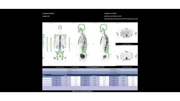 NM/CT 870 DR | GE Healthcare