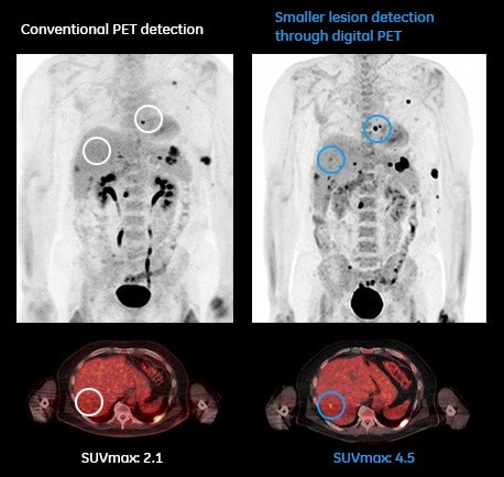 product-product-categories-pet-ct-discover mi image gallery-tab image new.jpg