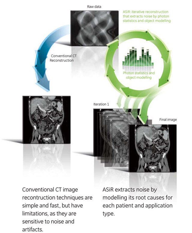 ASIR Technology Graphic
