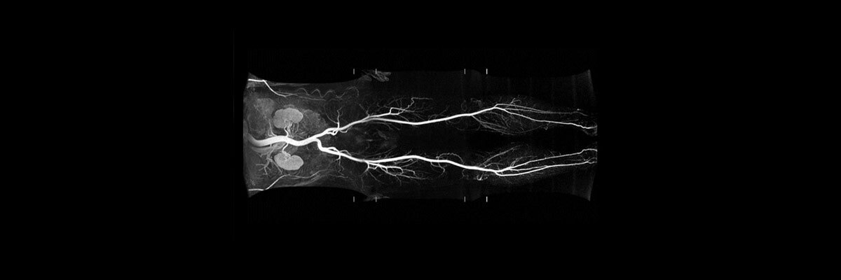 t-categories-magnetic-resonance-imaging-vascular-imaging-quickstep-quickstep_spotlight.jpg