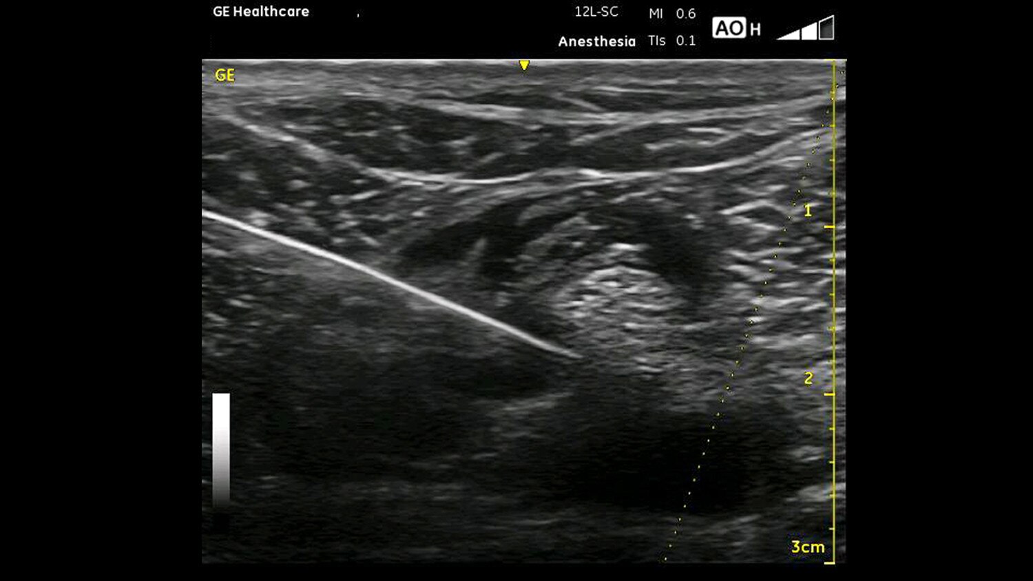 education-poc-anesthesia and chronic pain-gehc-poc-anesthesia-chronic-pain_spotlight_1_jpg