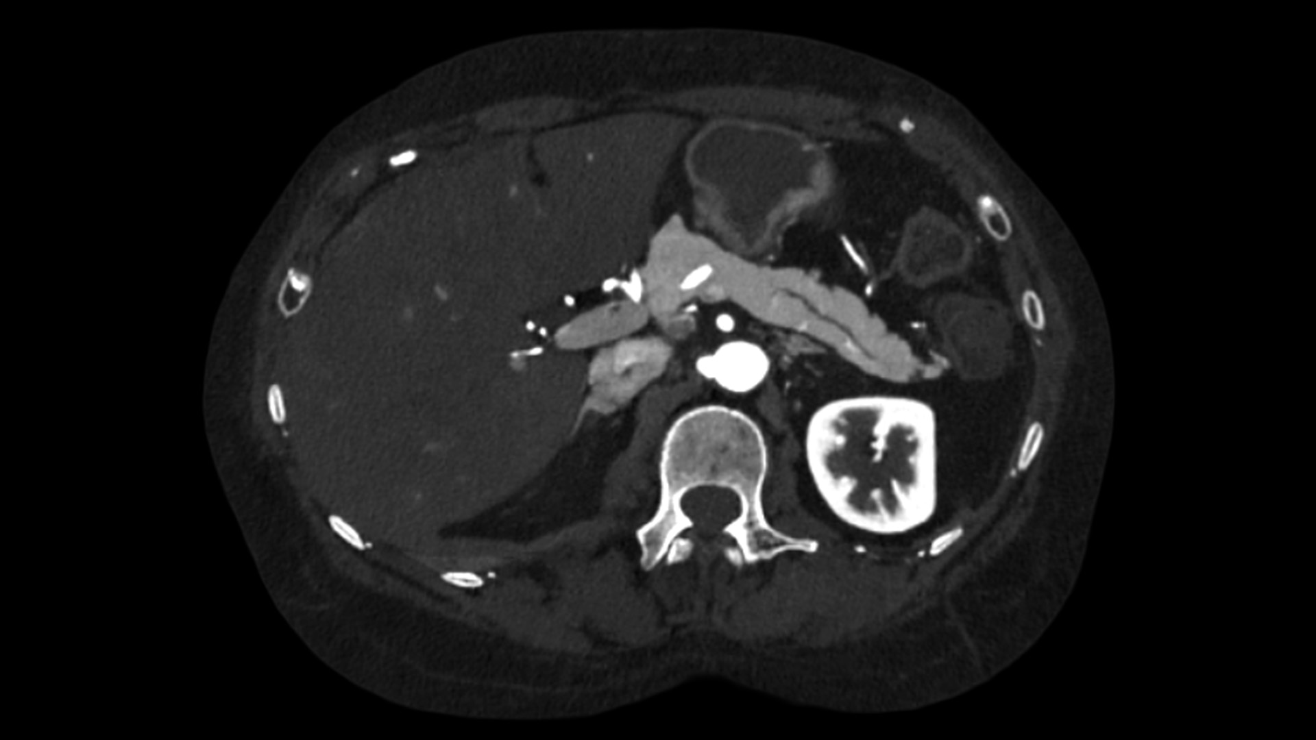 Product Media Carousel Image