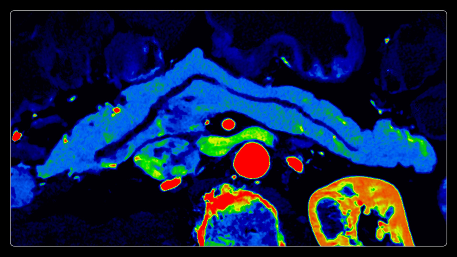 Product Media Carousel Image