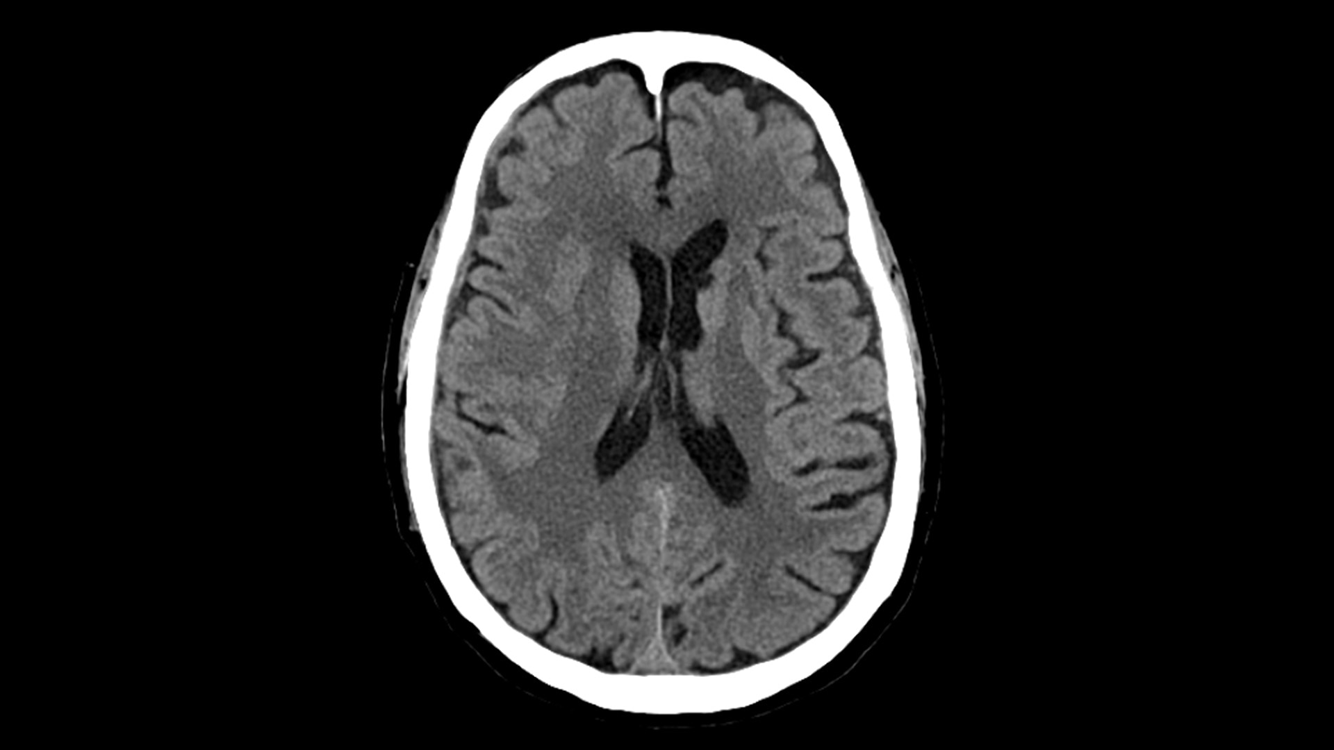 Product Media Carousel Image