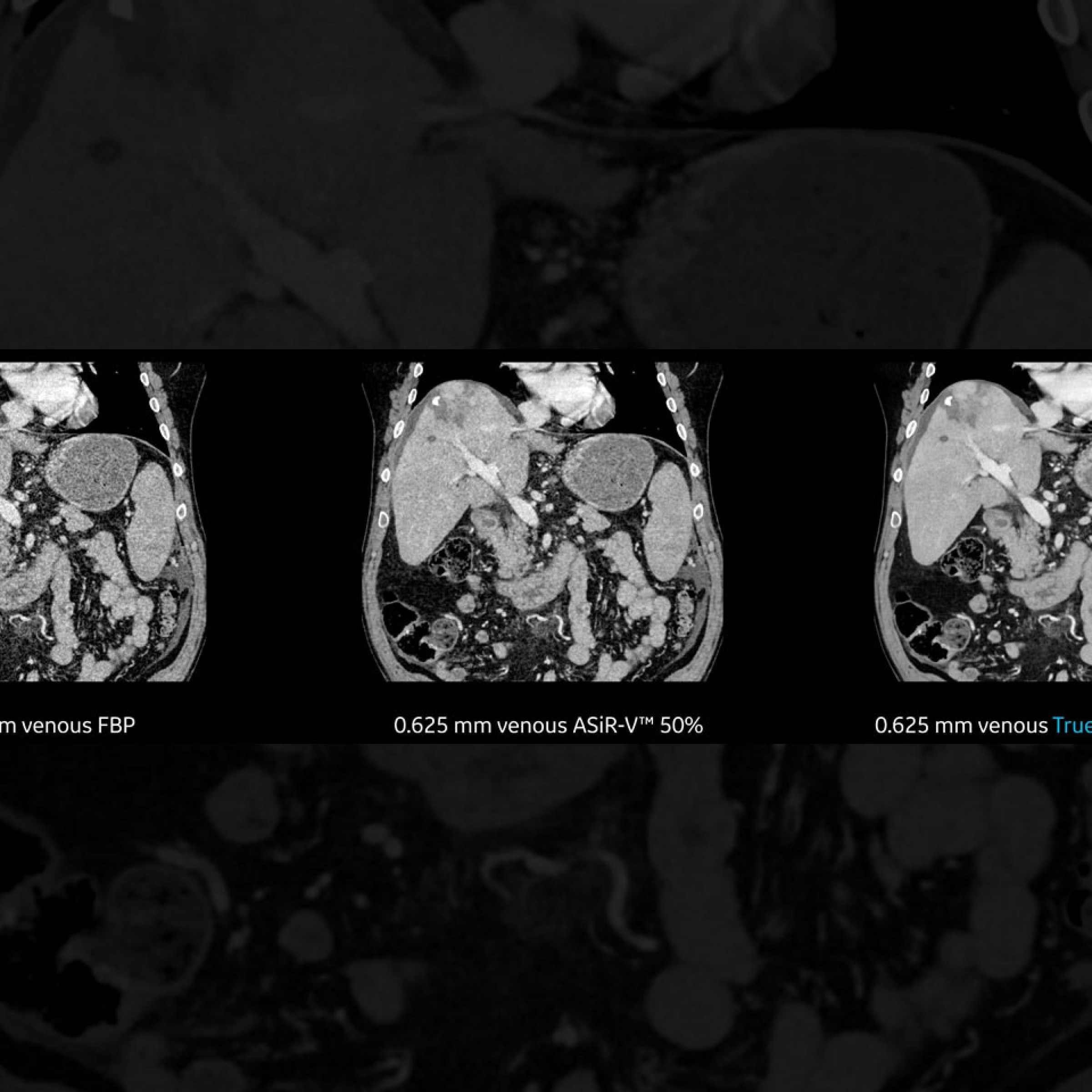 Collection Carousel Image