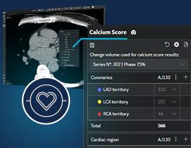 Cardiq Suite AW Advanced Visualization | GE HealthCare (United States)