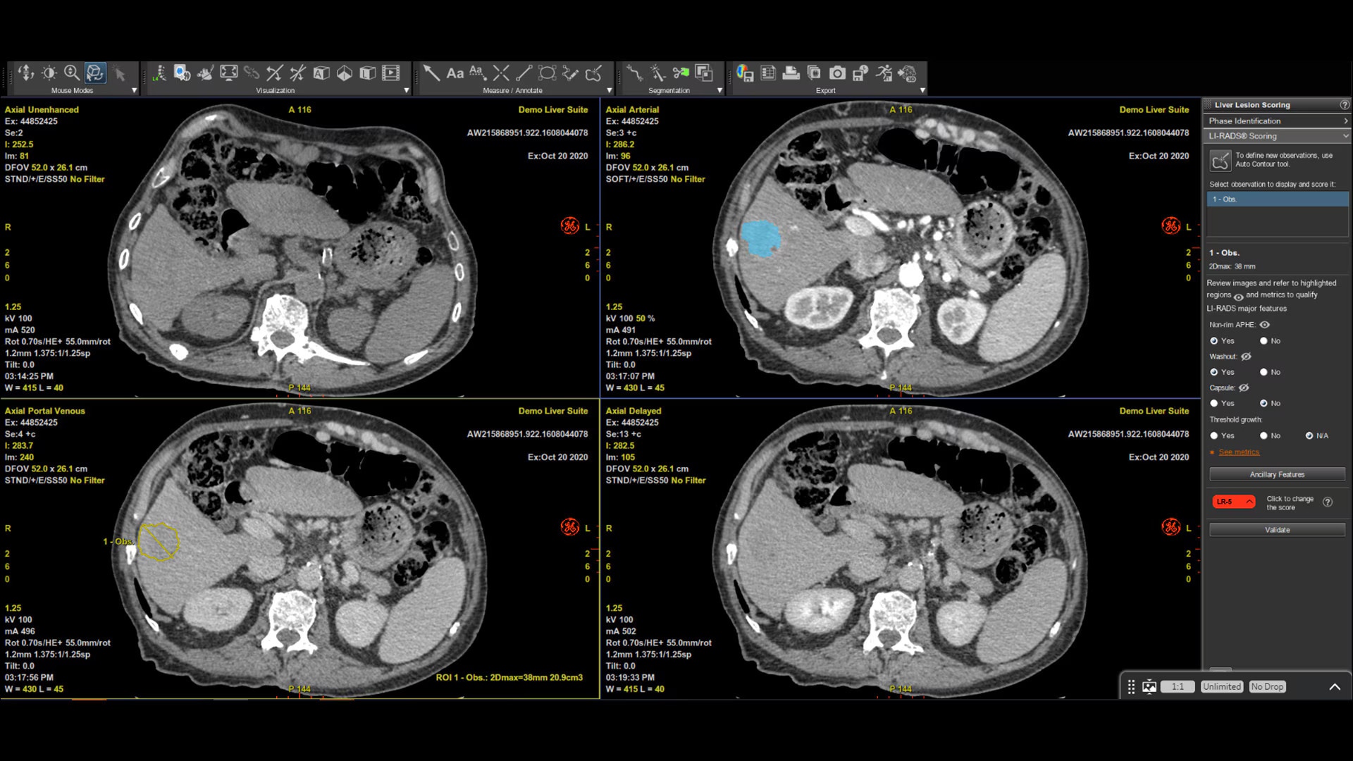 Product Media Carousel Image