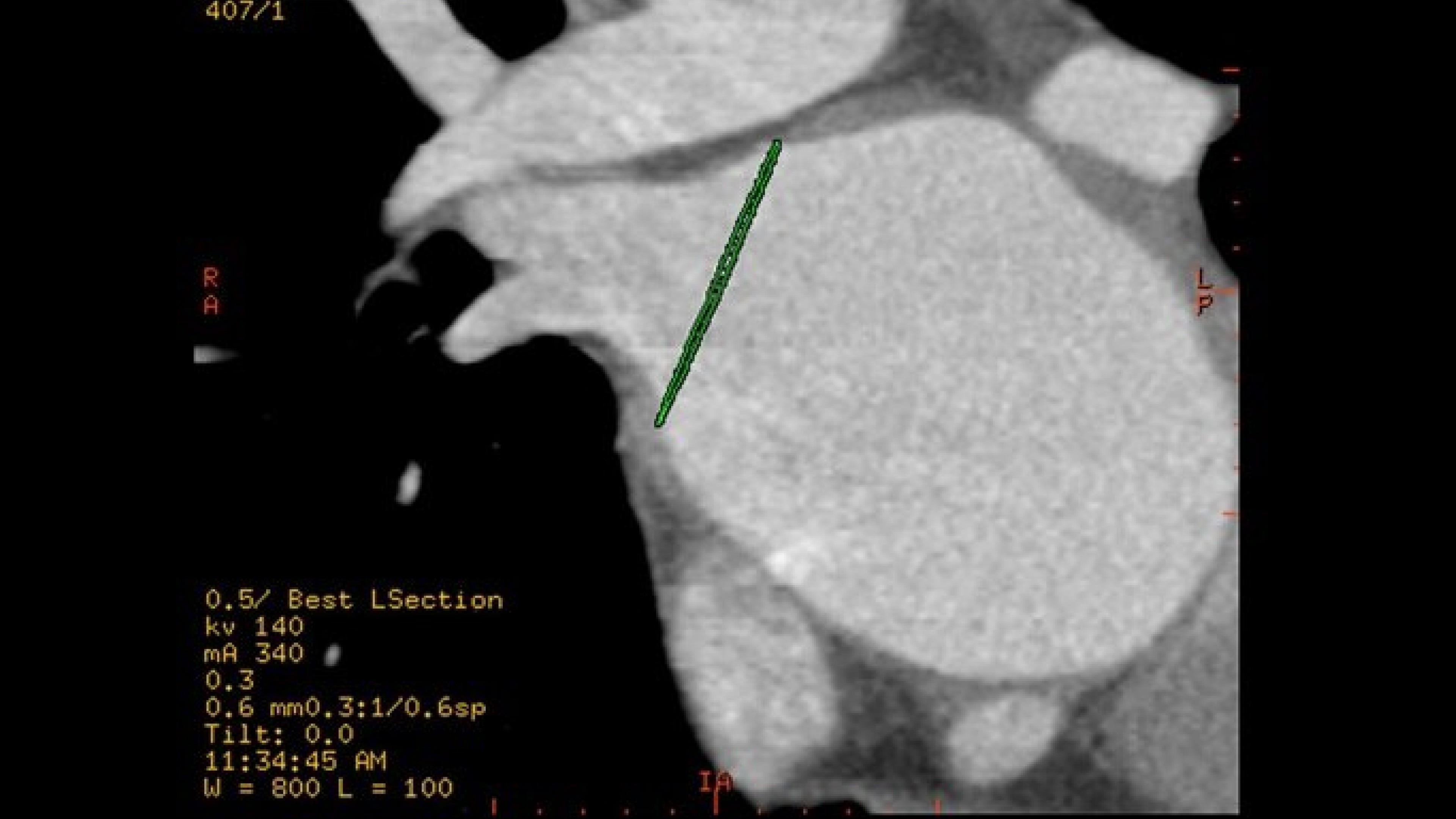 Product Media Carousel Image