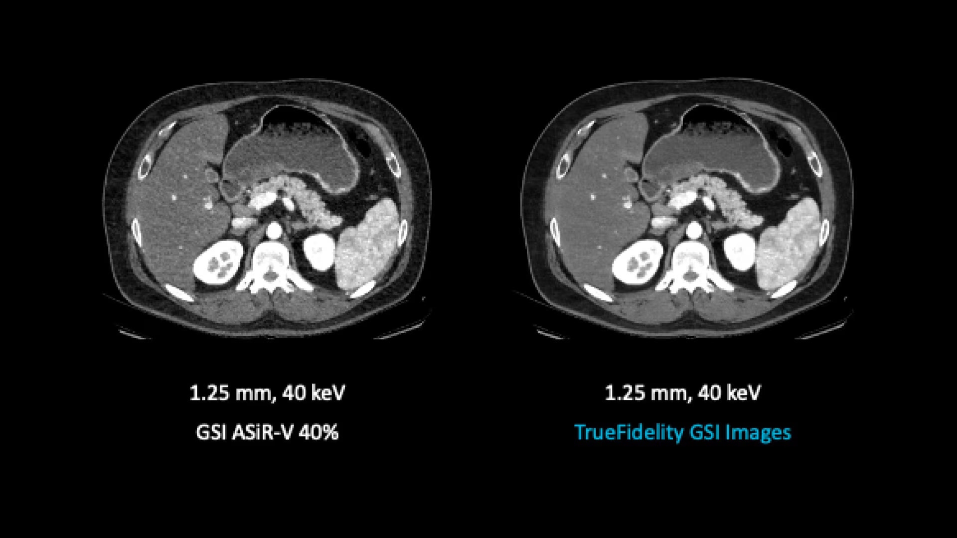Product Media Carousel Image