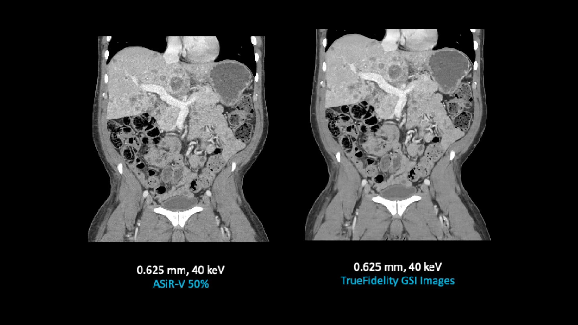 Product Media Carousel Image