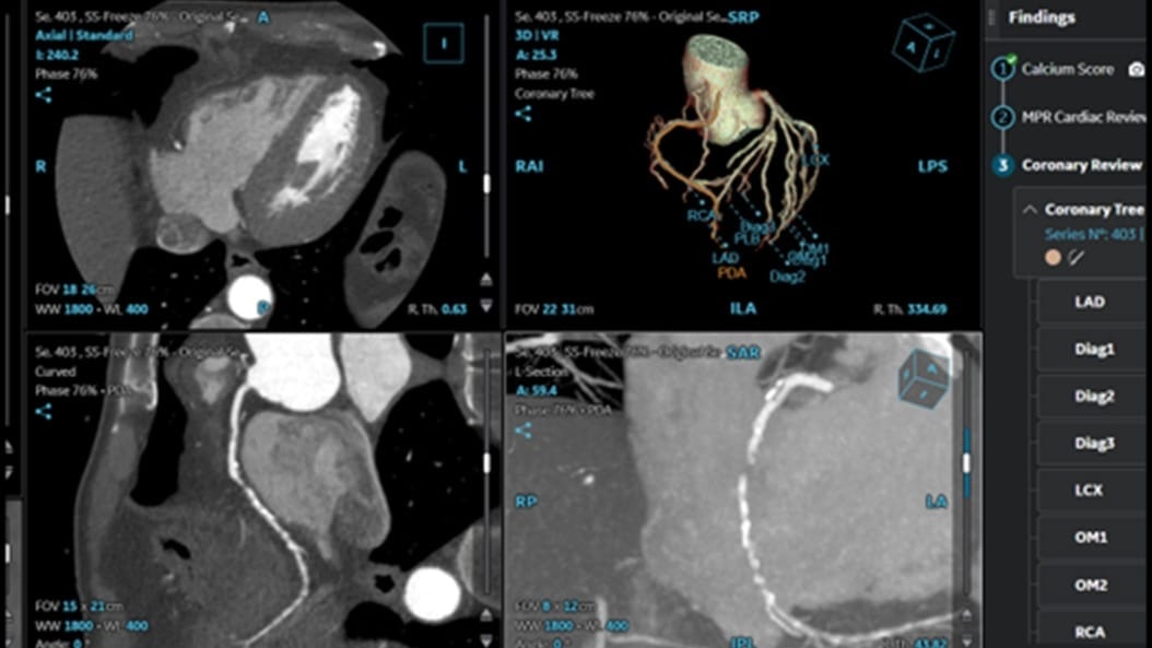 Product Switcher Carousel