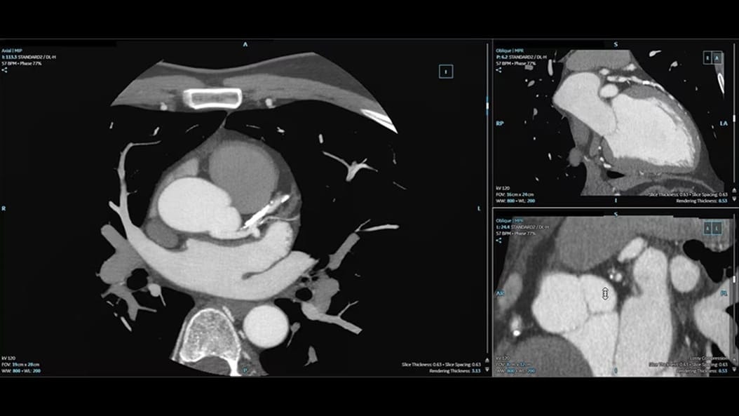 Product Switcher Carousel