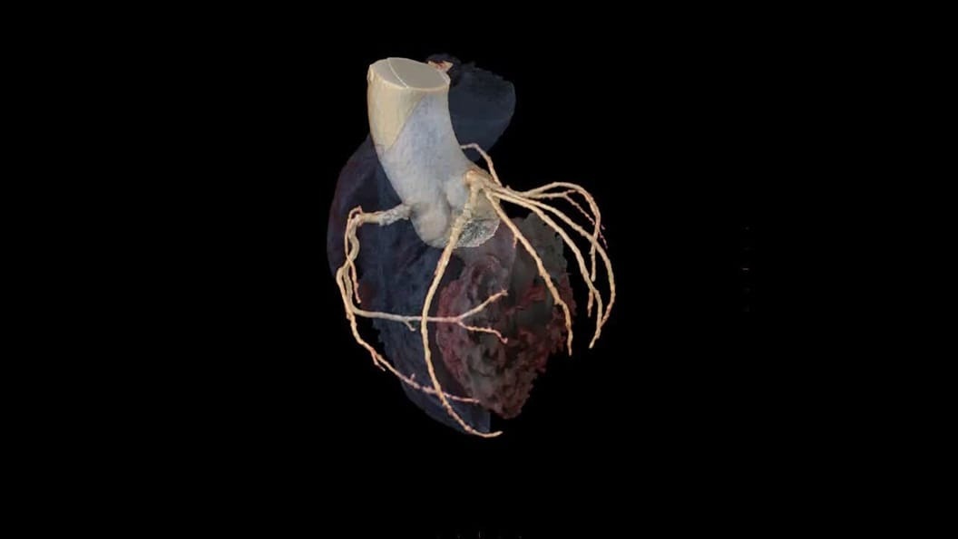 Product Media Carousel Image