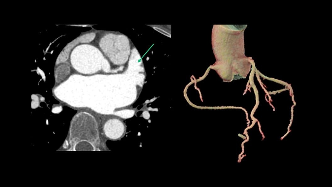 Product Media Carousel Image