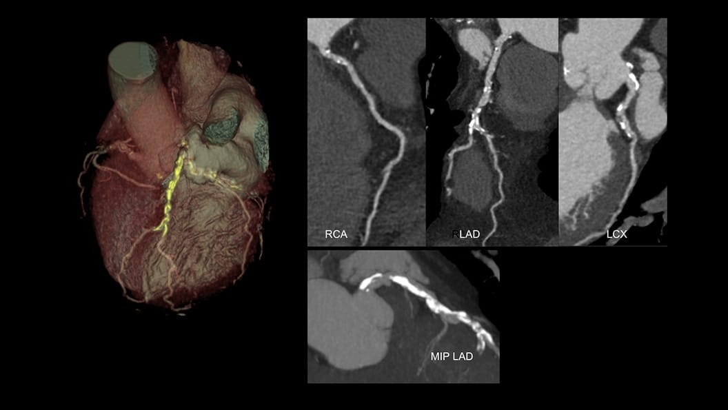 Product Media Carousel Image
