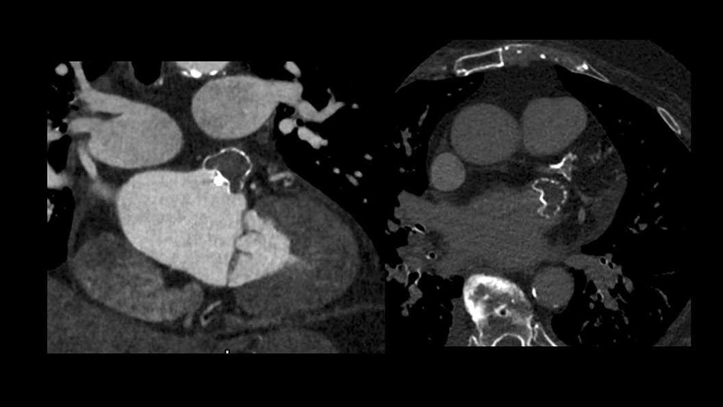 Product Media Carousel Image