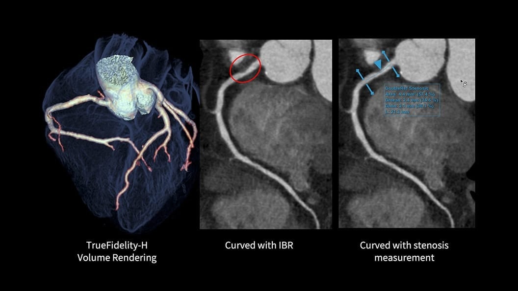 Product Media Carousel Image