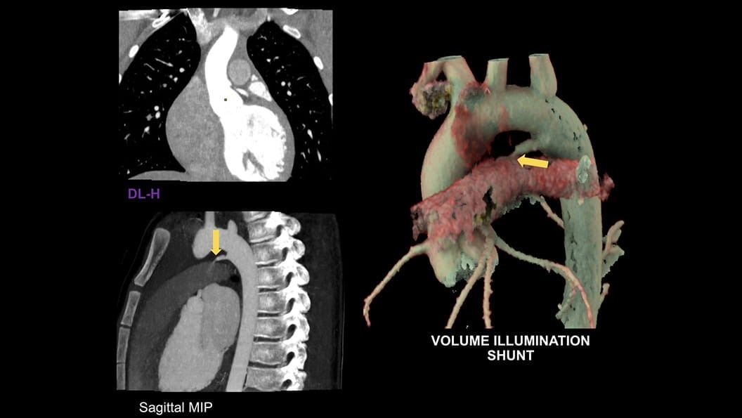 Product Media Carousel Image