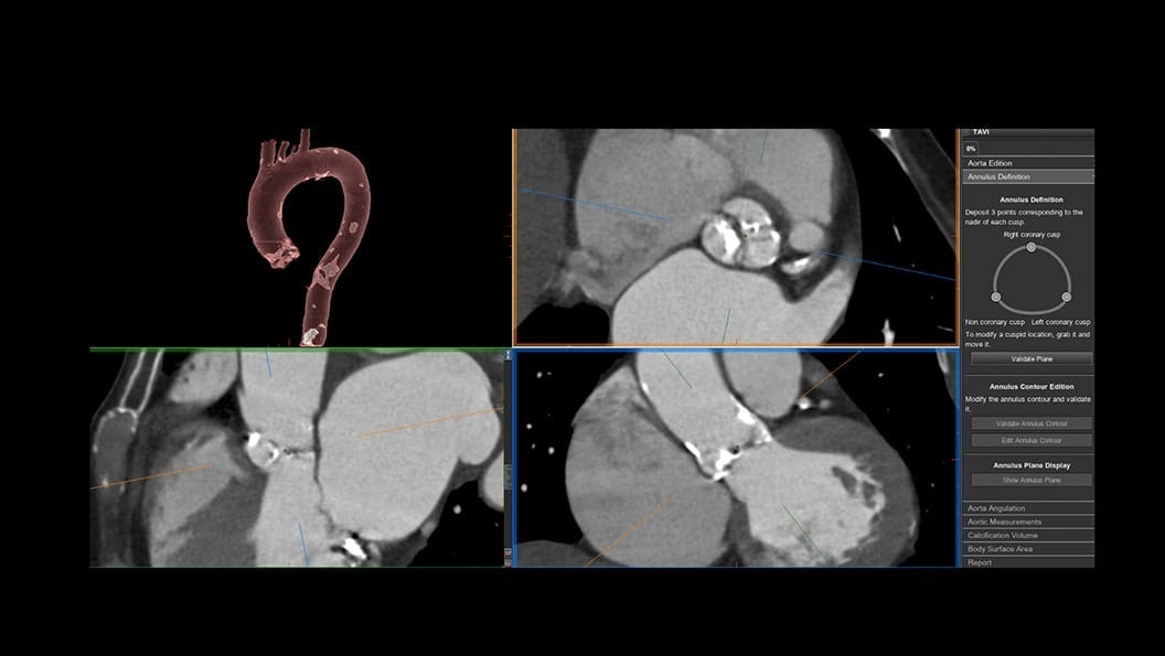 Product Media Carousel Image