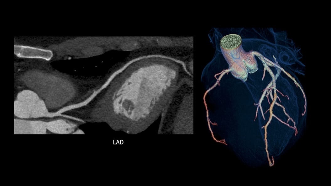 Product Media Carousel Image
