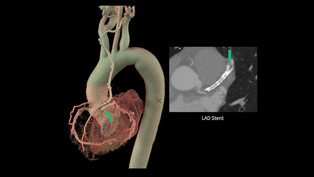 Product Media Carousel Image