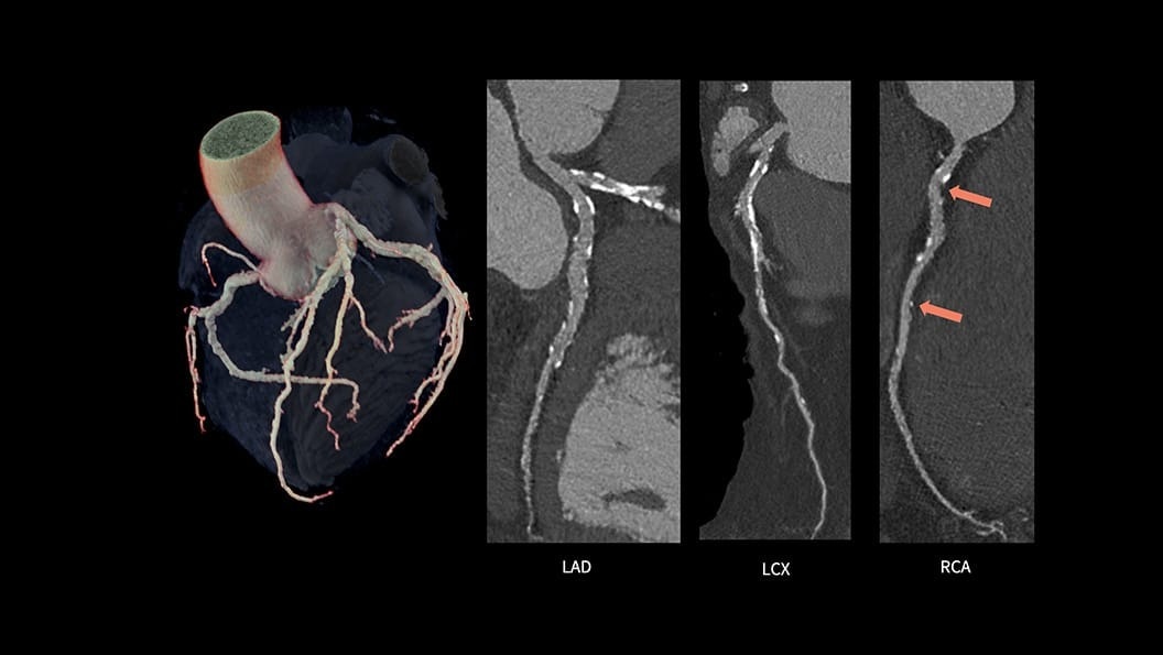 Product Media Carousel Image