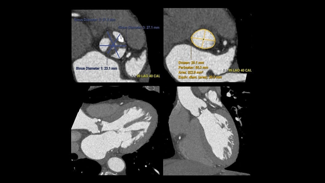 Product Media Carousel Image