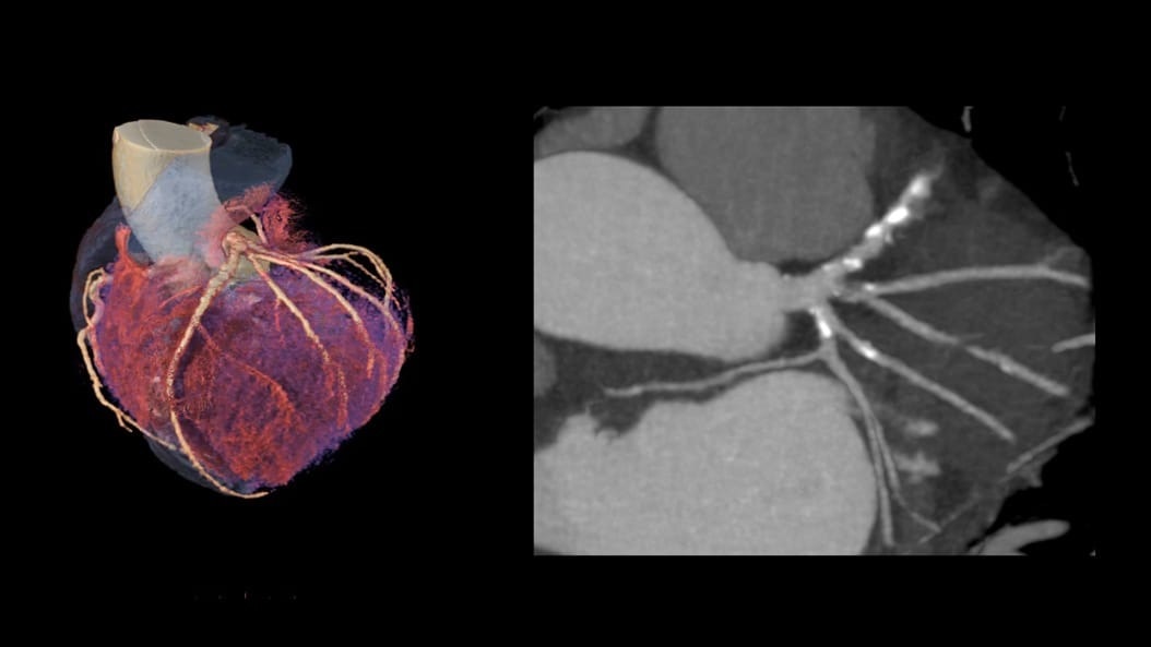 Product Switcher Carousel
