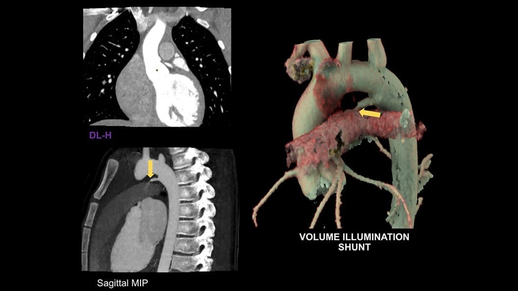 Product Switcher Carousel