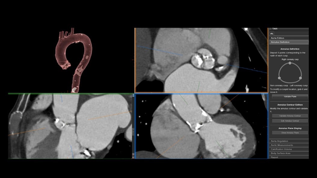 Product Switcher Carousel