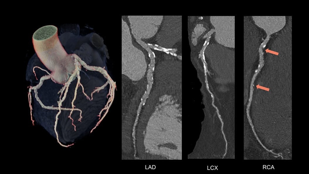 Product Switcher Carousel