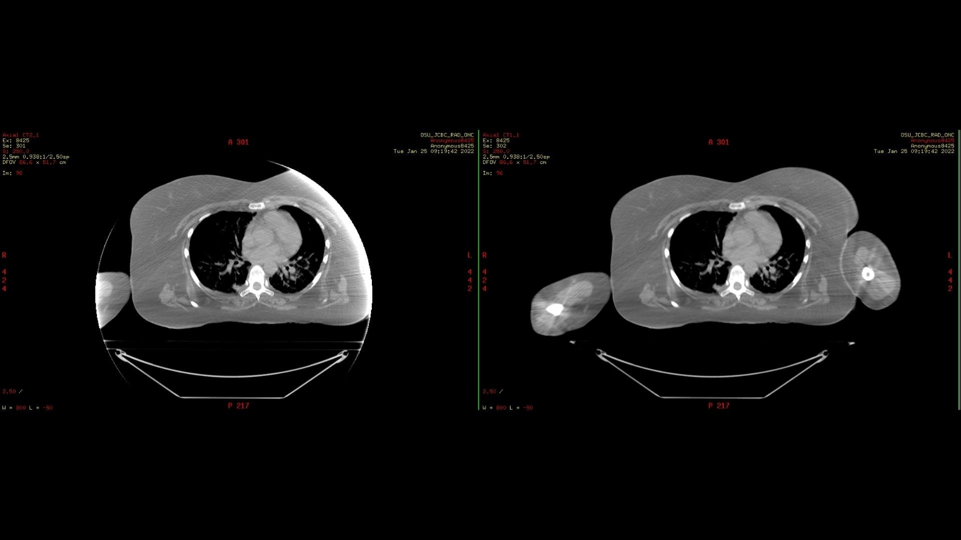 Product Media Carousel Image