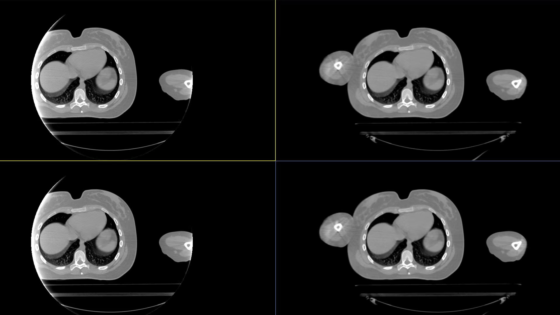 Product Media Carousel Image
