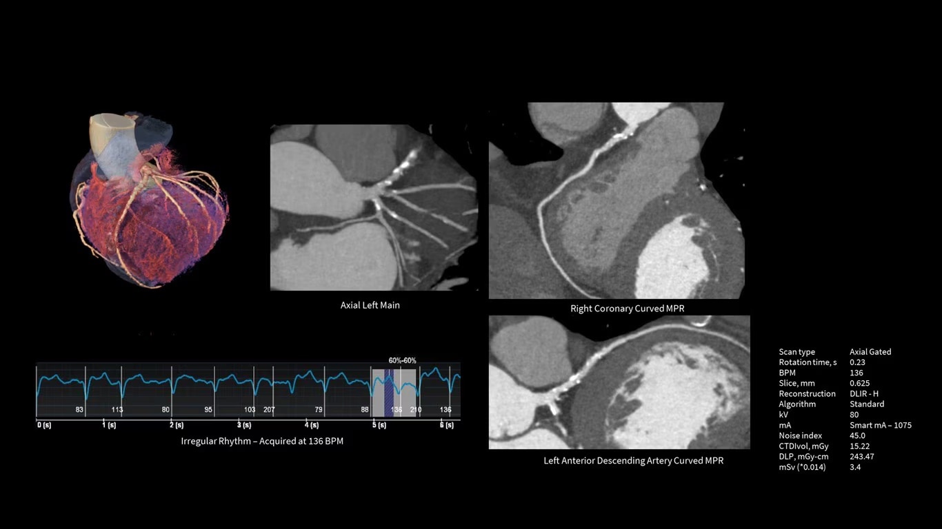 Product Media Carousel Image