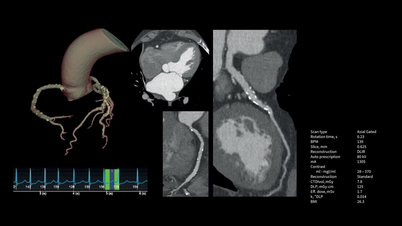 Product Media Carousel Image