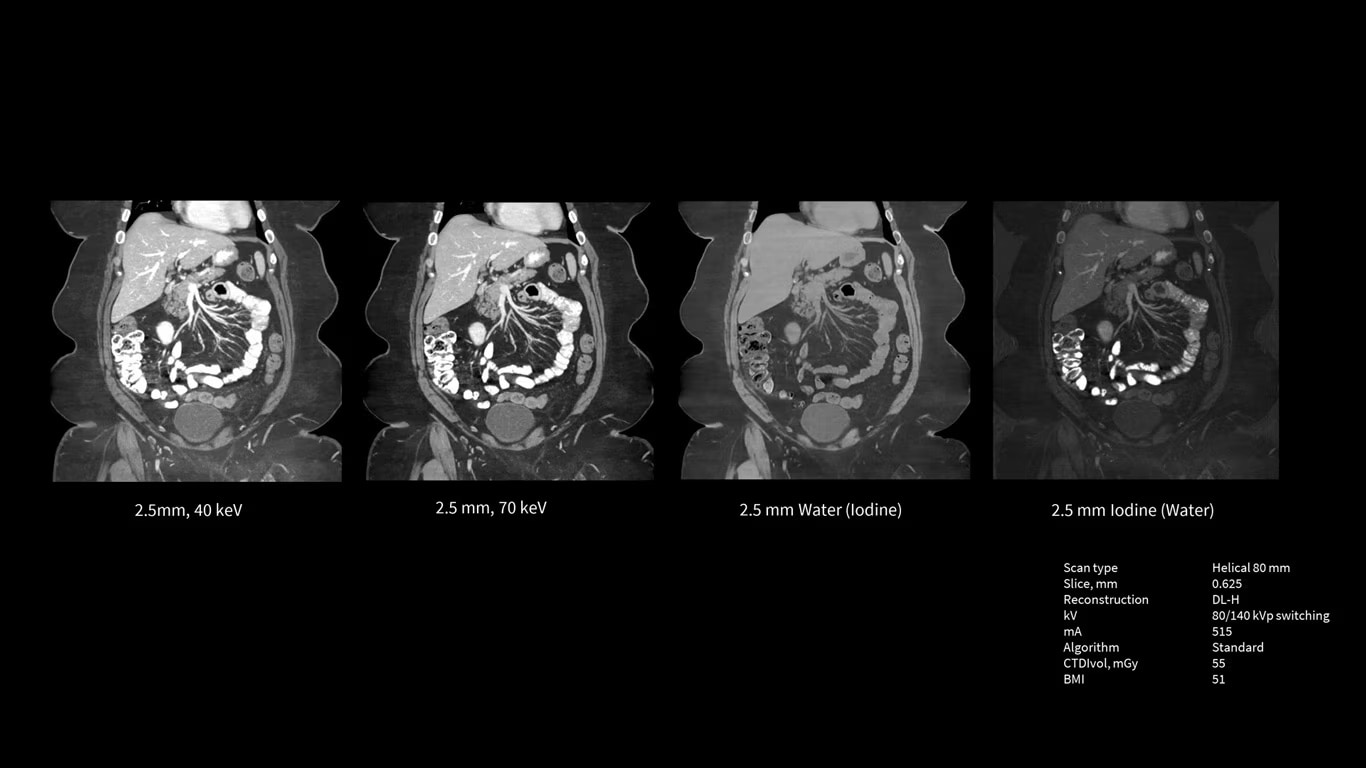 Product Media Carousel Image