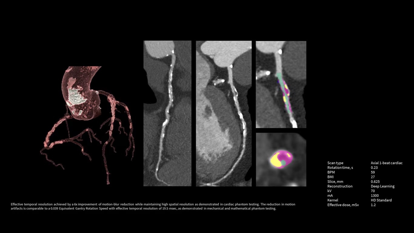 Product Media Carousel Image