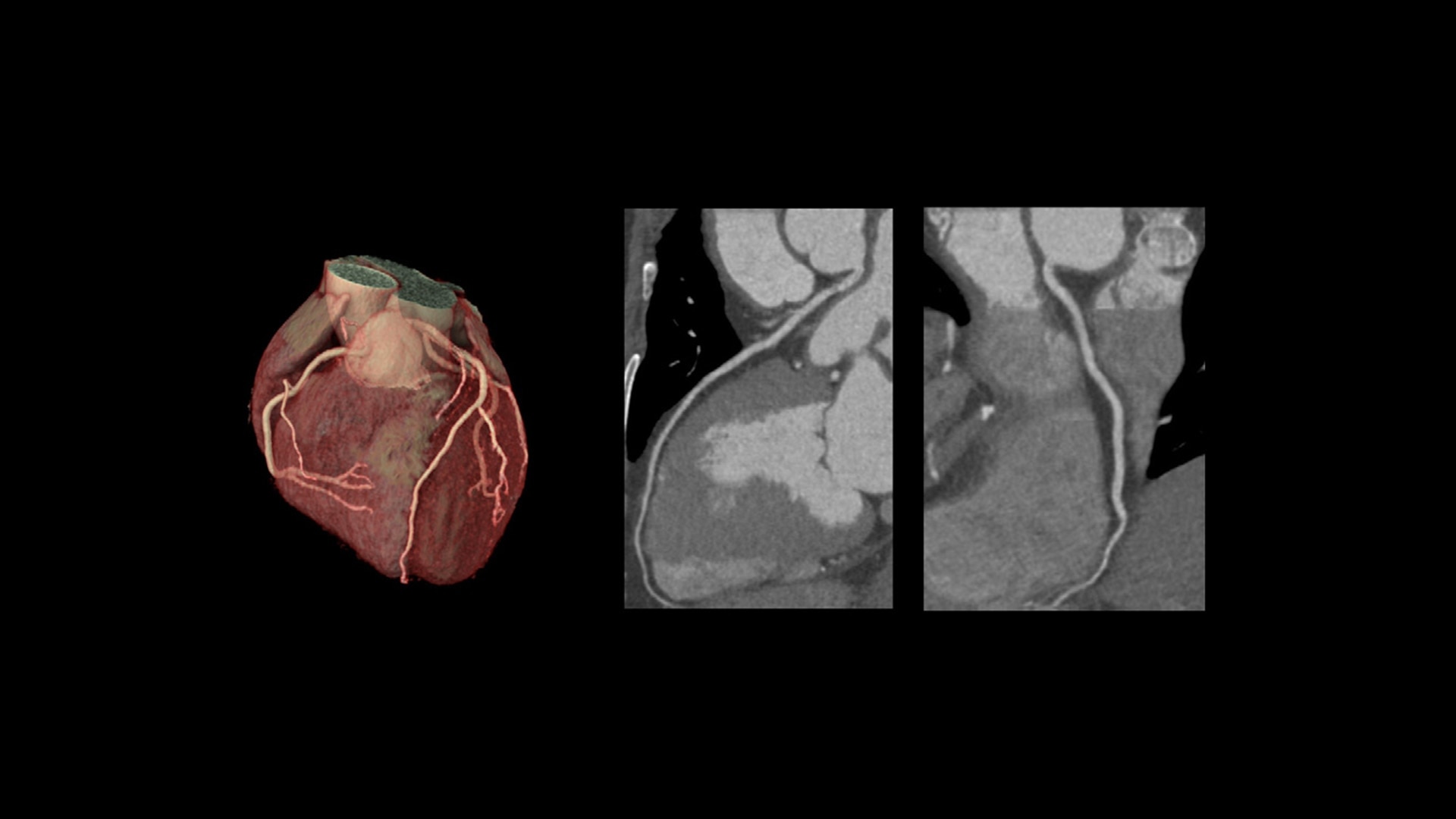 Product Media Carousel Image