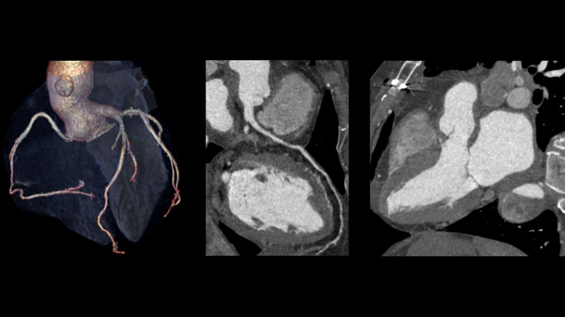 Product Media Carousel Image