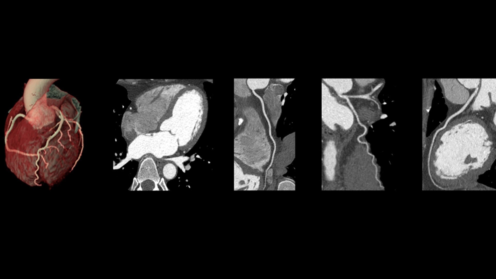 Product Media Carousel Image