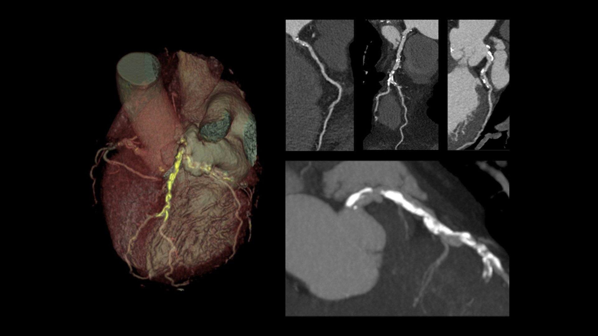 Product Media Carousel Image