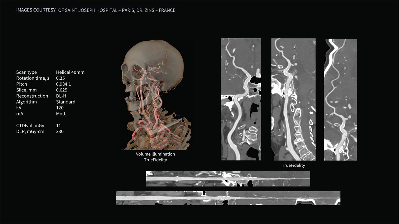 Product Media Carousel Image