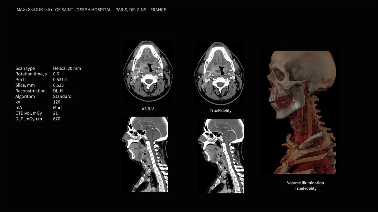 Product Media Carousel Image