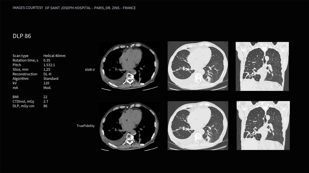 Product Media Carousel Image