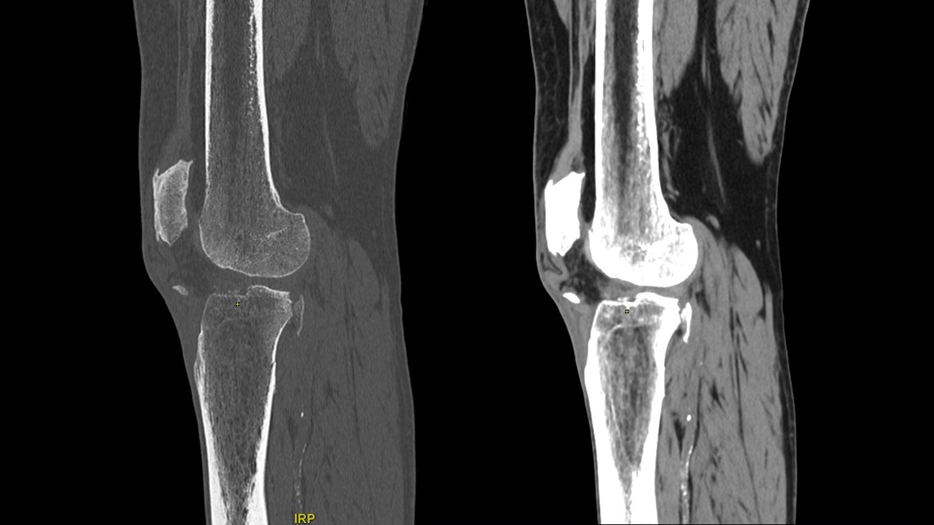 Product Media Carousel Image